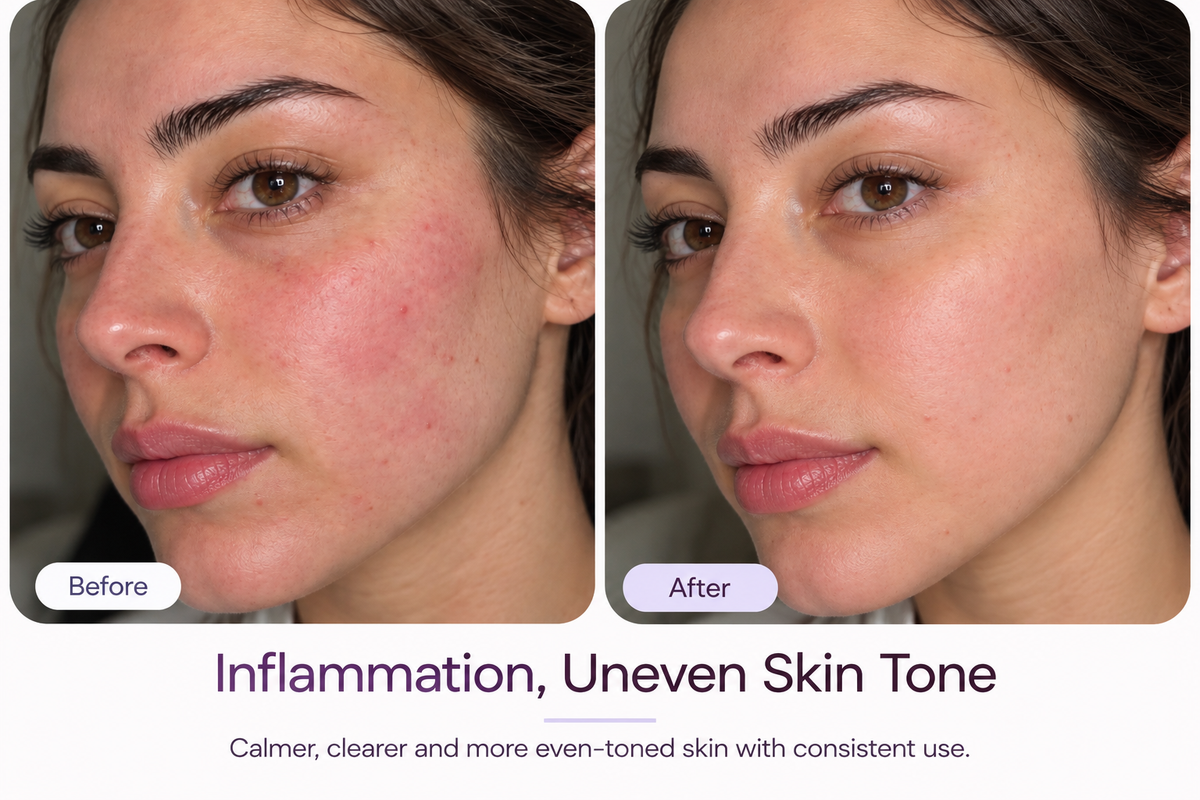 Before and after skincare result